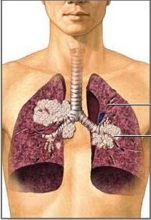 医用微量元素检测仪肺癌与微量元素的密切关系