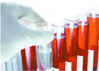 医用微量元素检测仪厂家谈微量元素的检查流程