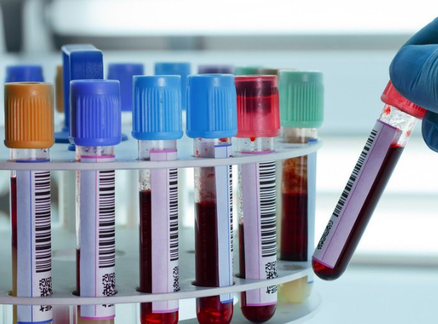儿童微量元素分析仪给小孩做微量元素检查需要抽血化验么？