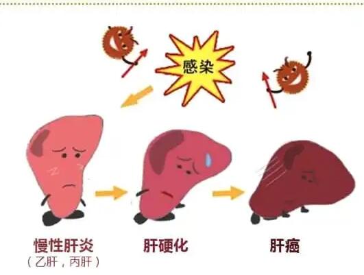 微量元素检测仪厂家提醒肝脏疾病治不好？要了解是否含铁食物摄入多
